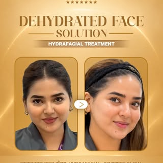 7th Year Anniversary - Up to 50% OFF! 🌟

✨Clearer Skin - Healthier Hair - Balanced Body Shape✨

Acn