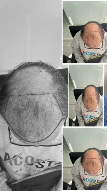 ¿Que le sucede a mi Cabello..?#recuperatucabello #recuperatucabello #cuidadocapilar #recuperatucabel