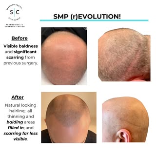 It's an SMP (r)EVOLUTION!!
The evolution from the beginning of the journey to the end shows a PRONOU