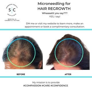 These are REAL results!!

I not only provide this service, but I tested it first... 
on MYSELF 
as s