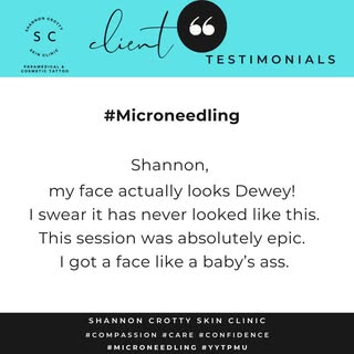 LOVE this testimonial I recently received!!🫶

#microneedling  is one of those multi-bonus treatment