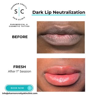 I just had the pleasure of working on these gorgeous smackers 💋
This is "fresh" after our 1st sessi