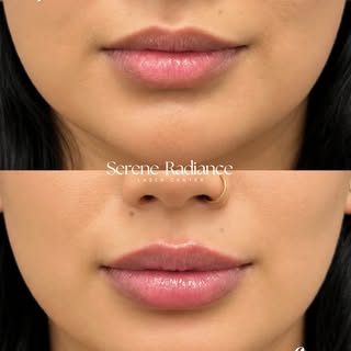 Whether you’re looking for a little hydration boost or full-on volume, we customize every treatment 