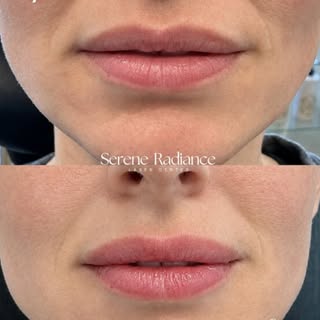 The goal is to enhance what’s already there. Whether you’re looking for a subtle hydration boost, a 