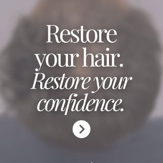 Looking for a Hair Transplant? Dr. Moussa offers the highest level of hair restoration and hair tran
