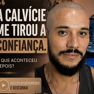 “A calvície me tirou a confiança.”

Foi exatamente assim que esse paciente chegou até nós.

Mas quem