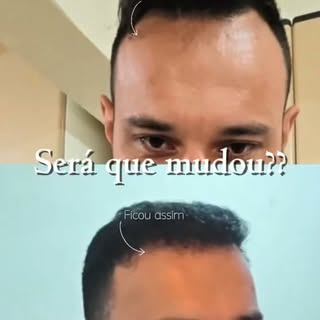 Será que mudou? 👀

Um novo desenho da linha frontal pode transformar muito mais do que o cabelo. Na