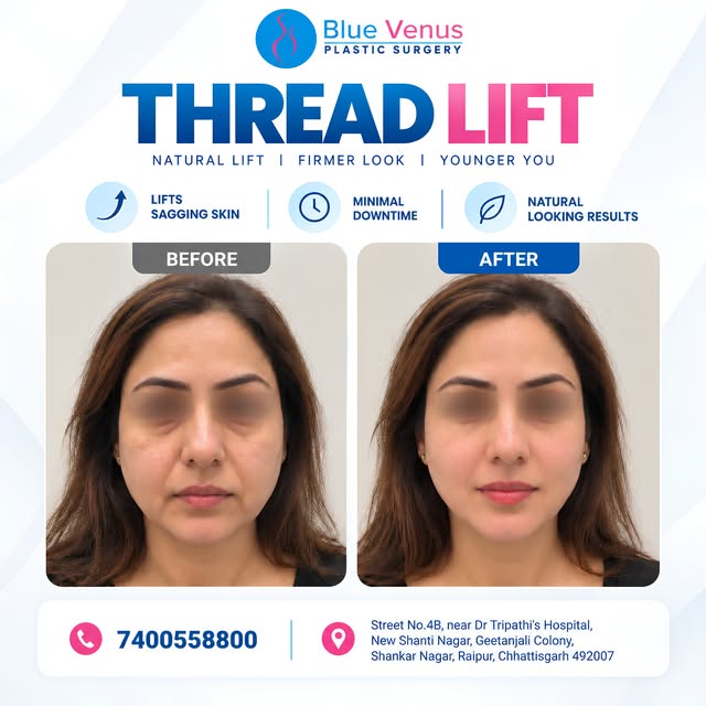 Want a subtle lift without looking “overdone”? 

Thread Lift is a minimally invasive aesthetic proce