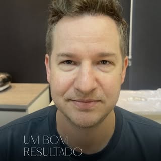 Aqui dá para perceber uma coisa muito interessante…

Eu poderia falar sobre a linha capilar, sobre a