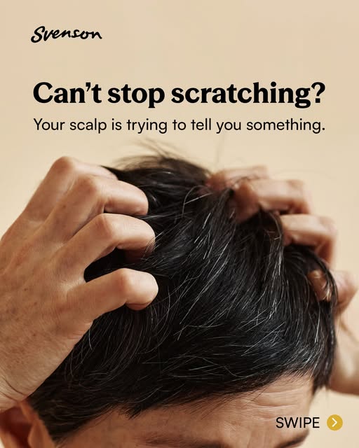 If you’ve noticed more itching, flaking, or shedding than usual, that’s your scalp asking for a litt