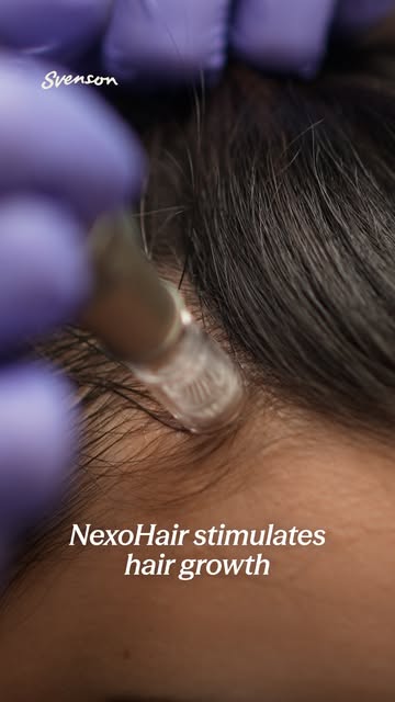 Listen to how Lyn Ching stands by with Nexohair and Svenson to take care of her hair.

Book your ses
