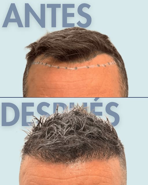 Sin filtros ni secretos: solo ciencia, un equipo experto y resultados que cambian vidas. Tras unos m