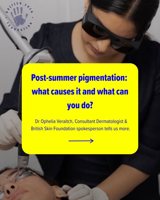 After a summer in the sun, many people notice dark patches or uneven skin tone becoming more visible