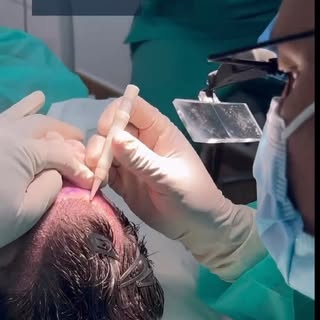 😊Recupera tu pelo de forma discreta en DKapilar Clinic.
💆‍♂️Distribución óptima de folículos para 