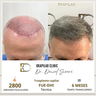 🌟 ¡Nuestro trabajo habla por sí mismo! 🌟

📸 Mira este sorprendente antes y después de nuestro tra