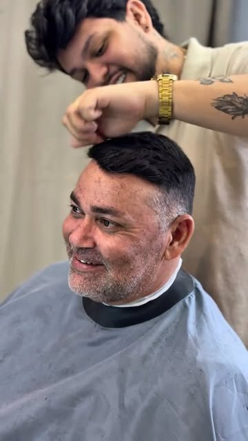 #protesecapilar #transplantecapilarfue #cabelo #calvicie #tratamentocapilar