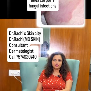 Skin infection fungal tinea cruris , tinea corporis #DR.RACHI’S SKIN CITY 
Skin ,Hair & Laser Clinic