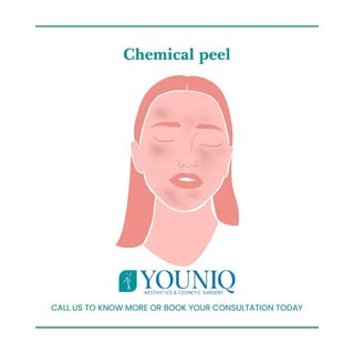 A chemical peel is a procedure in which a chemical solution is applied to the skin to remove the top