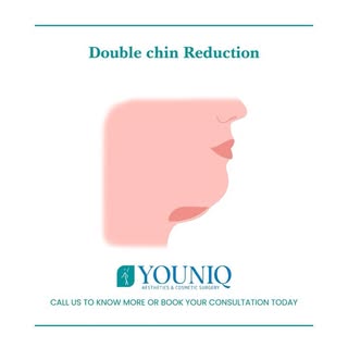 A double chin is a common problem in which excess fat and loose skin beneath your chin make your fac