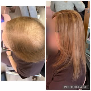 The difference a little hair can make to your whole confidence is everything 🪄✨ 

Thank you for cho