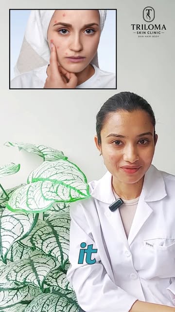 🚨 **STOP POPPING YOUR PIMPLES!**

Think popping a pimple makes it disappear faster? Think again. 👀
