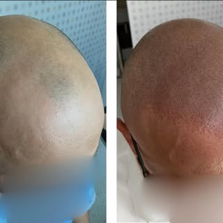 3️⃣…2️⃣…1️⃣…. 💣Nadrabiam instagramowe zaległości 😎

Efekt 3 sesji #scalpmicropigmentation 

Natura
