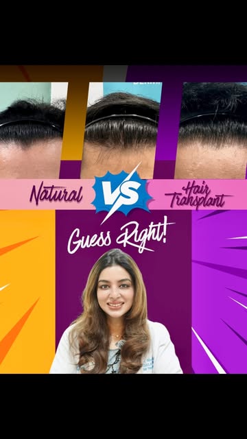 Can you spot the hair transplant? 👀 
In this video, one of the three hairlines is a hair transplant