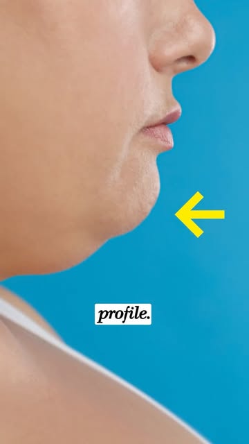 A weak or recessed chin can significantly affect your facial profile but there’s more than one way t