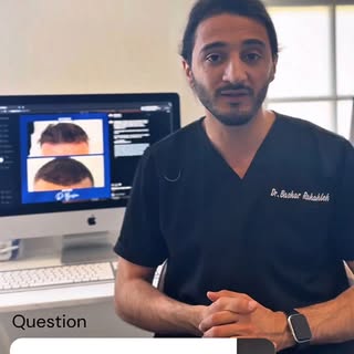 💬I’m answering your most frequently asked questions about hair transplants — from myths to methods 