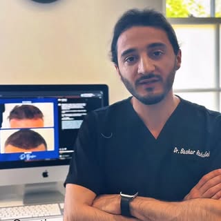 💬I’m answering your most frequently asked questions about hair transplants — from myths to methods 