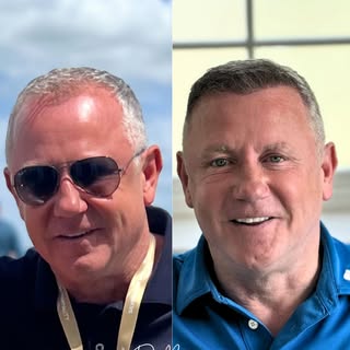 I implanted 1,900 grafts for Stephen Sedgley, former pro footballer, to restore his hairline and cro