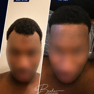 ✨ Another successful transformation, another confident smile! 💯

Nothing is more rewarding than see