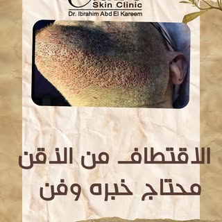 "يا جدعان، الذقن مش للشكل بس! 😎"

طب إيه رأيكم لو قولتلكم إن شعر الذقن ممكن يبقى حل سحري للي عانوا 