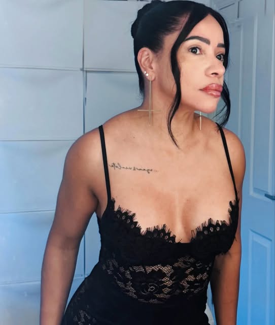 Our lovely patient 4 years after Breast Augmentation with Surgmed Health #breastaugmentations #breas