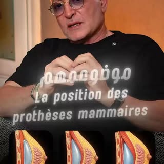 👀 Implant
 كيطلع… والآخر كيمشي على جنب ملي كتحرك يديها؟ علاش؟

Position ديال les implants mammaires