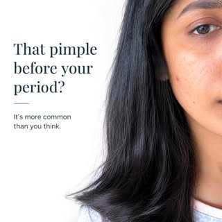 That one pimple before your period? You’re not alone.

Hormonal acne commonly appears 7–10 days befo