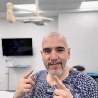 رحلتي معكم لزراعة الشعر
#باب_النجار_مخلع