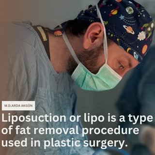Liposuction is a type of fat removal procedure used in plastic surgery.

#plastikcerrahi #estetikcer