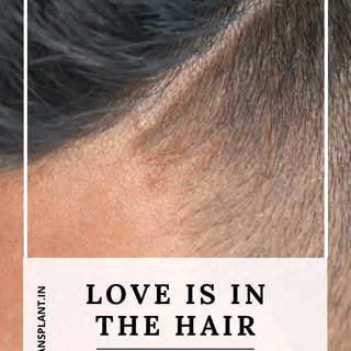 Look attractive with New hair.
Get rid of all your hair problems with hair Transplant, PRP and other