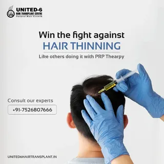 You can win the fight against Hair Thinning like thousands of others did it with Hair Transplantatio