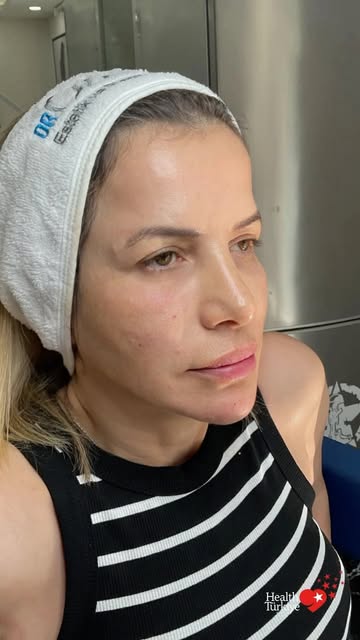 Is it possible to look more refreshed and lifted without changing your facial features?

Over time, 