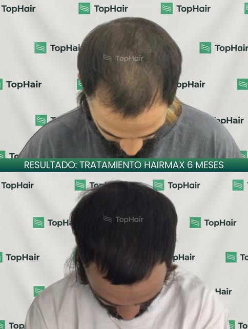 Seis meses. Ese es el tiempo exacto que separa el antes y el después de este resultado.

El responsa