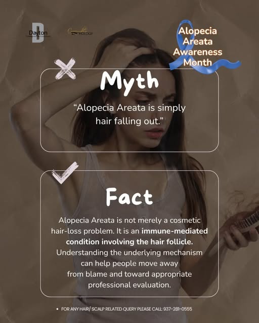 💙 Alopecia Areata Awareness Month | Myth vs. Fact

Myth: “It’s just hair loss.”

Fact: Alopecia Are