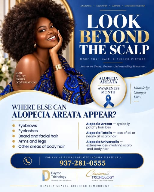 Alopecia Areata Doesn’t Always Stop at the Scalp

Think Alopecia Areata only means patchy hair loss 