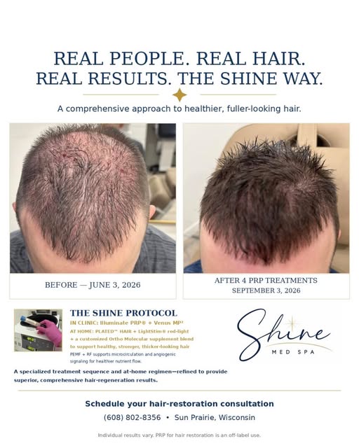 ✨ REAL PEOPLE. REAL HAIR. REAL RESULTS. THE SHINE WAY. ✨

This incredible transformation followed a 