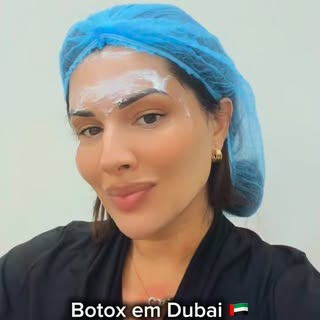 BOTOX é vidaaaaa 🗣️✨😅🙌 @drjulioyoshimura @champselyseescenter