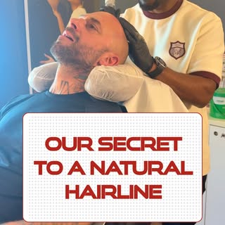 Ever seen an SMP hairline that looks way too perfect? 👀

Yeah… real hairlines don’t look like that.