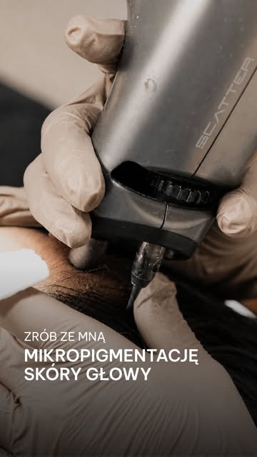 Spędź ze mną dzień na zabiegu pigmentacji skóry głowy metodą SHADOW 👀
 
Każdy zabieg wykonujemy kro