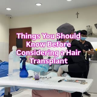 Considering a hair transplant? These key insights will help you make an informed decision ☺️