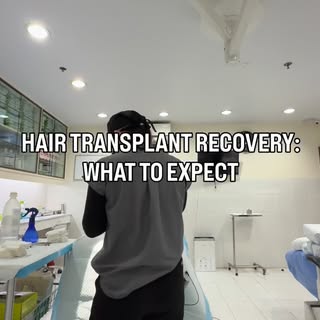 Recovery after a hair transplant is gradual and completely normal. From redness to regrowth, every s